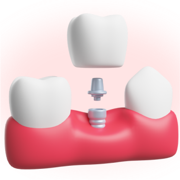 Дизайн картинки наперед